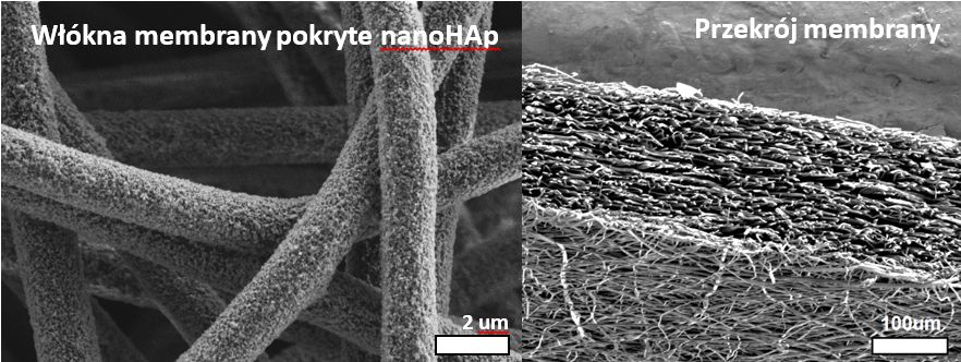 Zdjęcia SEM struktury membrany dla stomatologii