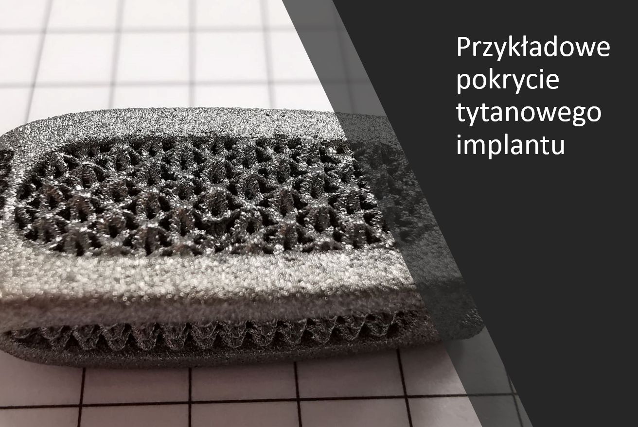 Implant z osadzonymi nanocząstkami